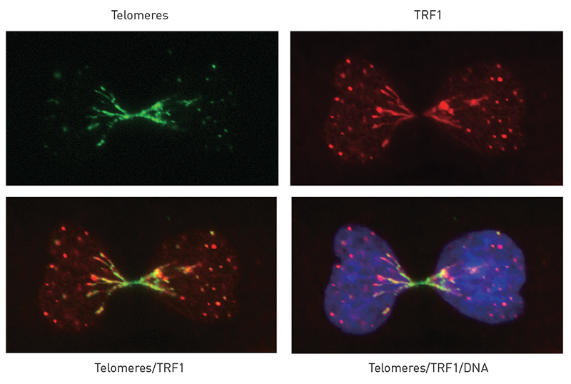 imaging of Telomeric Bridges